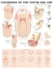 Poster Disorders of the Teeth and Jaw 20 in x 26 in With Lamination Ea