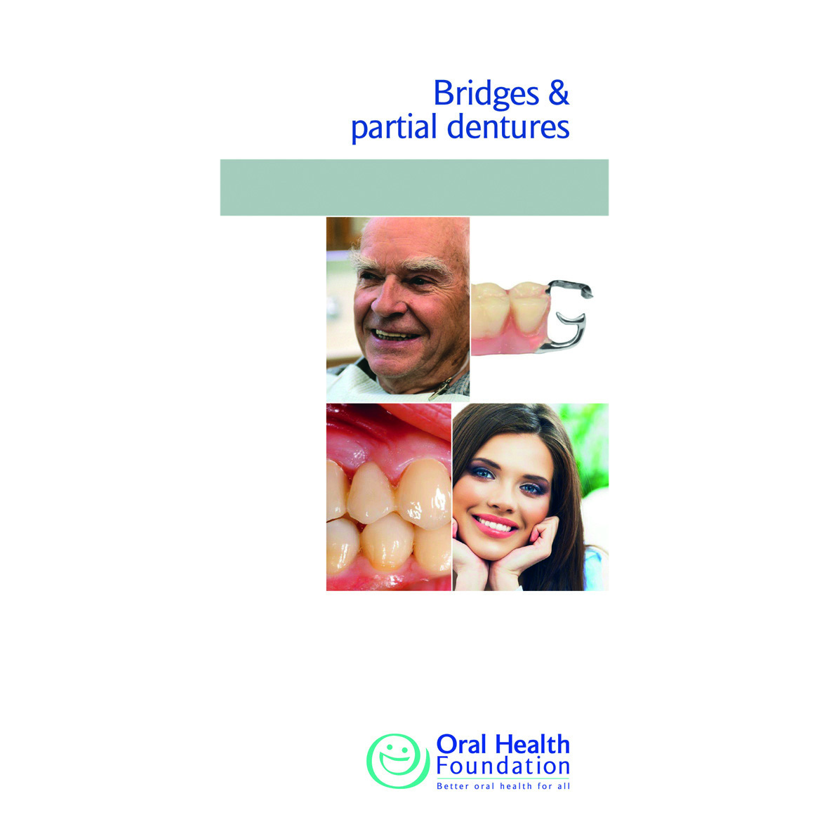 BDHF Leaflets Bridges/Partial Denture 100pk