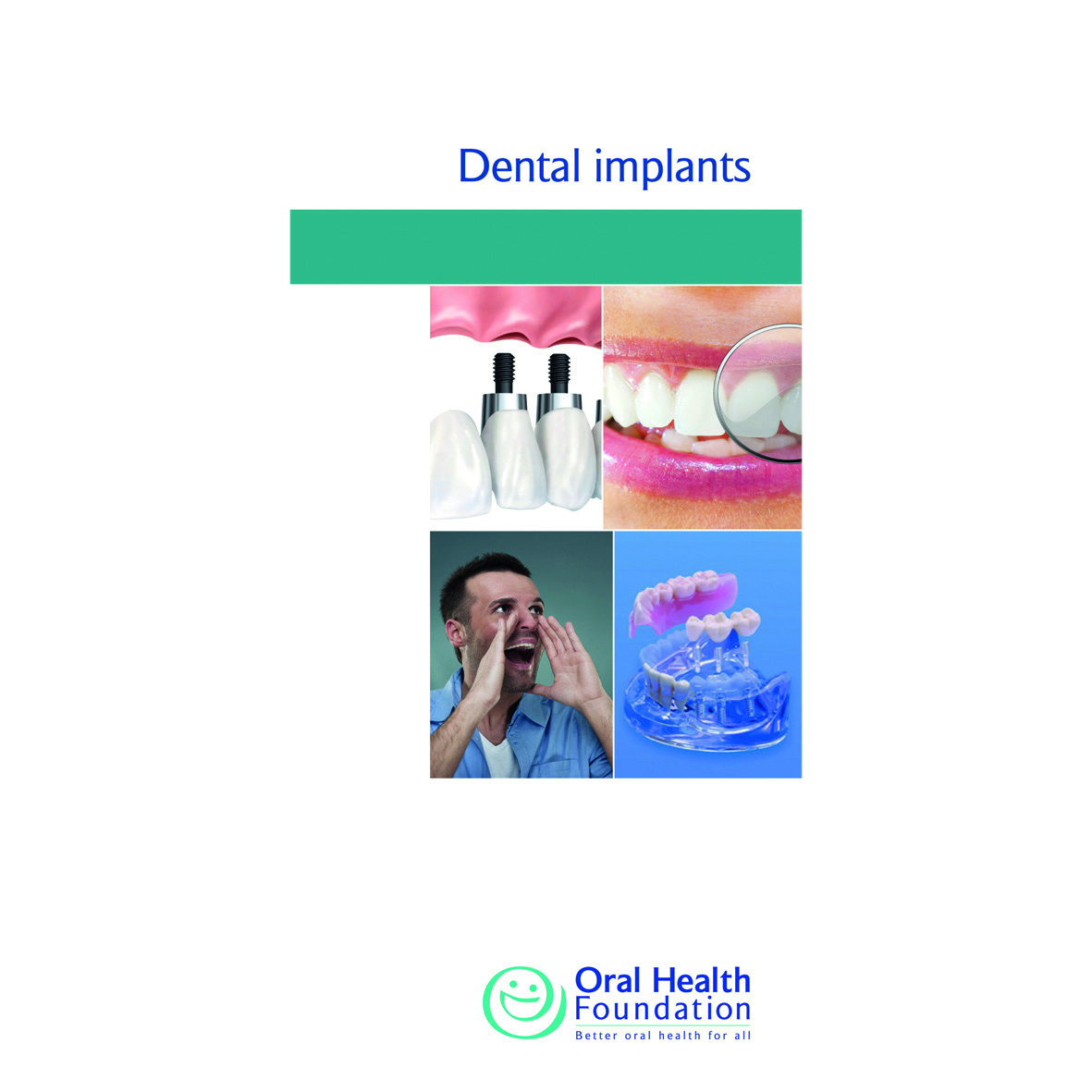 BDHF Leaflets Implants 100pk