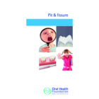 BDHF Leaflets Pit & Fissure Sealants 100pk