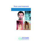 BDHF Leaflets Root Canal Treatment 100pk
