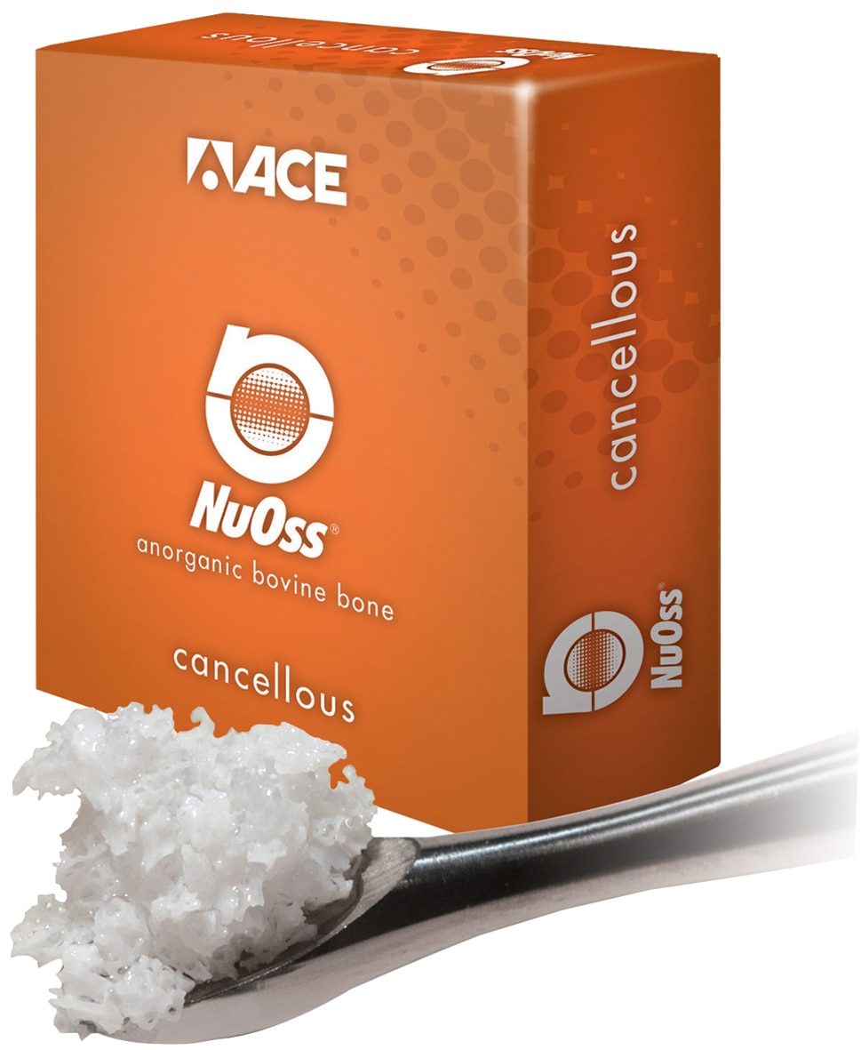 1091909_UK_Product_03_-NuOss-Cancellous-Granules-0251mm-025g.jpg
