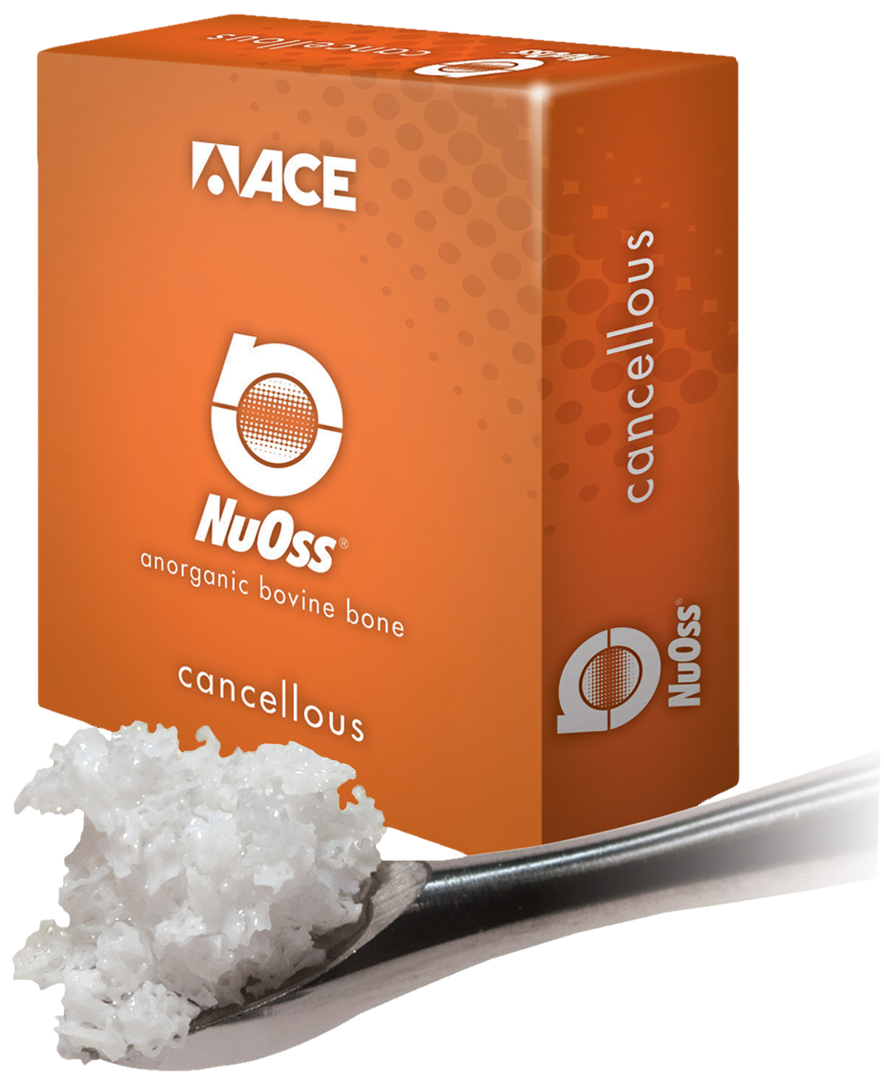 NuOss Cancellous Granules 0.25-1mm 1g
