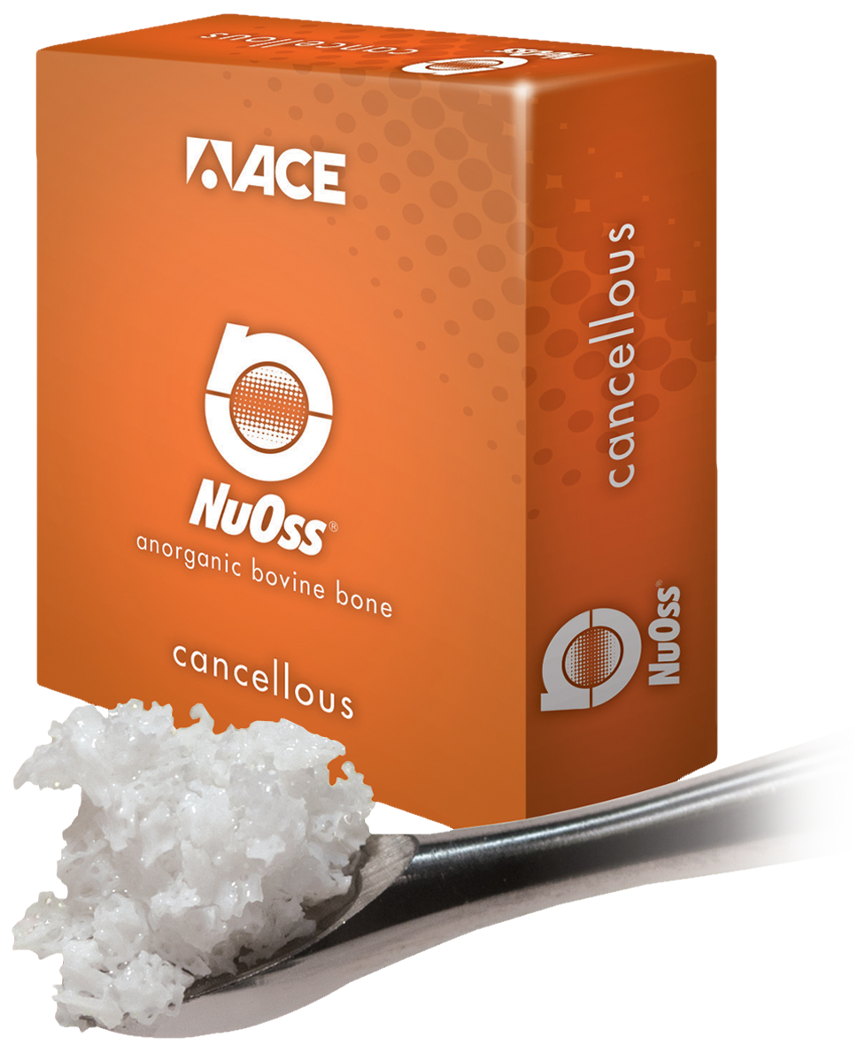 NuOss Cancellous Granules 0.25-1mm 2g