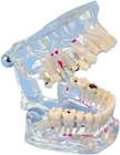 Demonstratie Gebitsmodel transparant - 80508