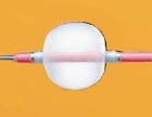 Fogarty Arterial Thru-Lumen Embolectomy Catheter 4Fr