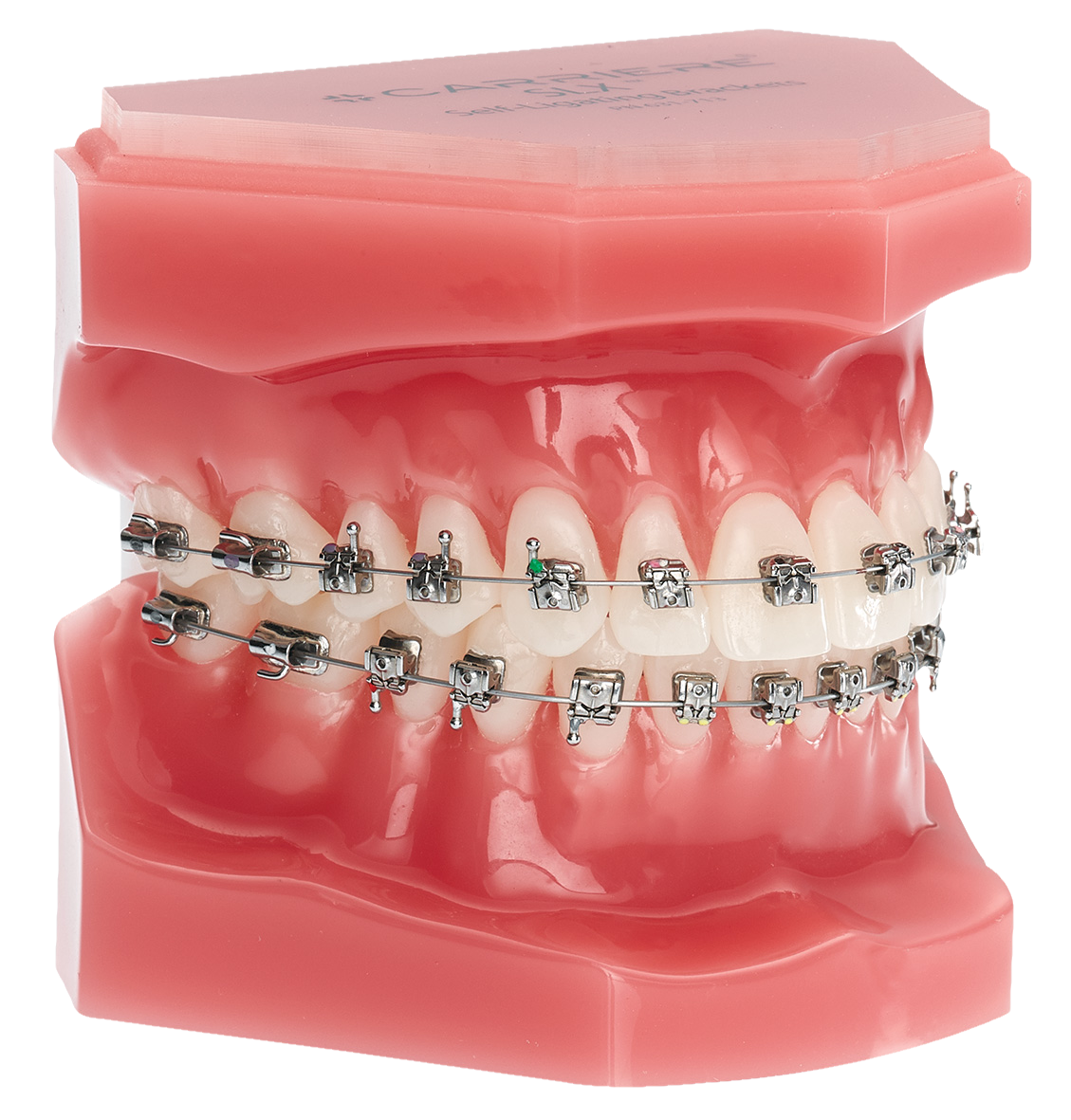 Stone Model with NPE2