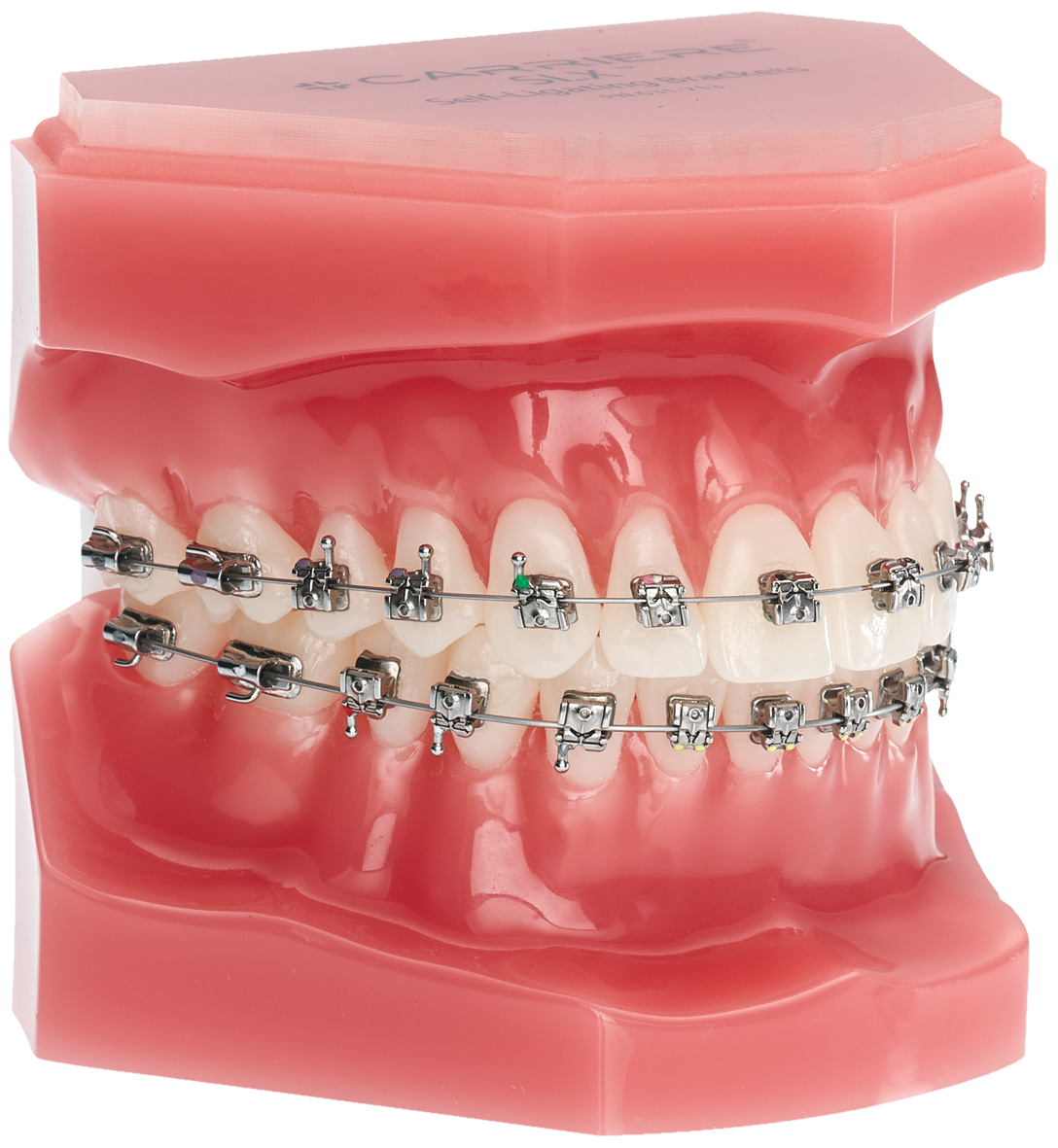 Carriere SLX Bracket Optimized Damon Standard Torque .022 U/L 5x5 Hooks on 3,4,5