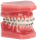 1165547_UK_Front_01_s_-Carriere-SLX-Bracket-Optimized-Damon-Standard-Torque-022-UL-5x5-Hooks-on-345.png