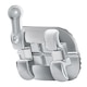 1165864_UK_Front_01_-Aria-Bracket-MBT022-UR3-0T-8A-0O-10pk.jpg