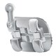 1165936_UK_Front_01_-Aria-Bracket-MBT-022-UL-45-With-Hook-7-Torque-0-Angulation-0O-AntiRotation-10pk.jpg