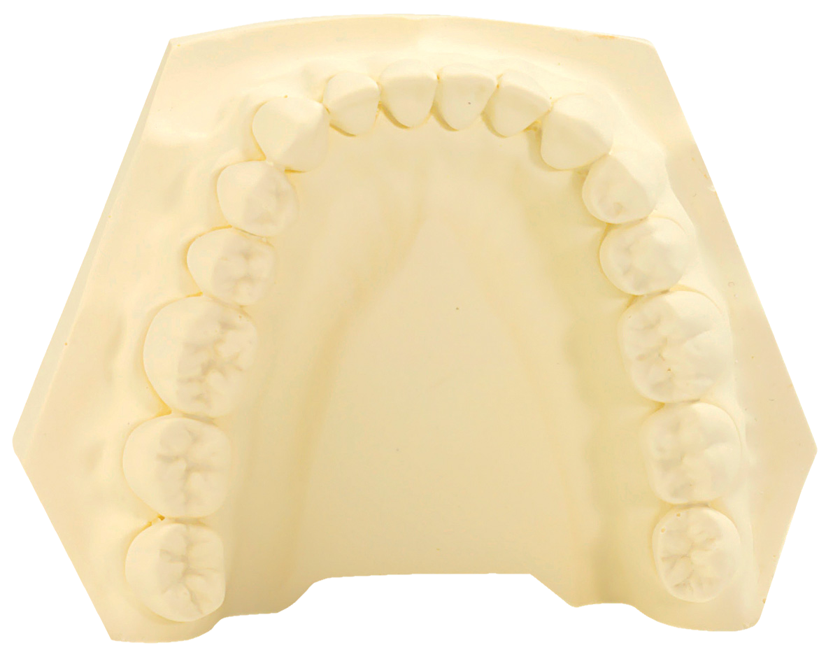 SLX Plaster Type 4 Yellow 20kg