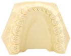 SLX Plaster Type 4 Yellow 20kg