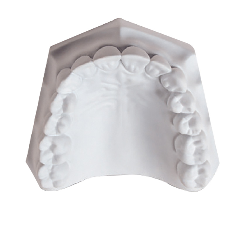 SLX Gibraltar Alabaster Natural Type II 20kg