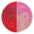 TSA: Trypticase Soy Agar Culture Media 5% Sheep Blood Biplate 10/Package