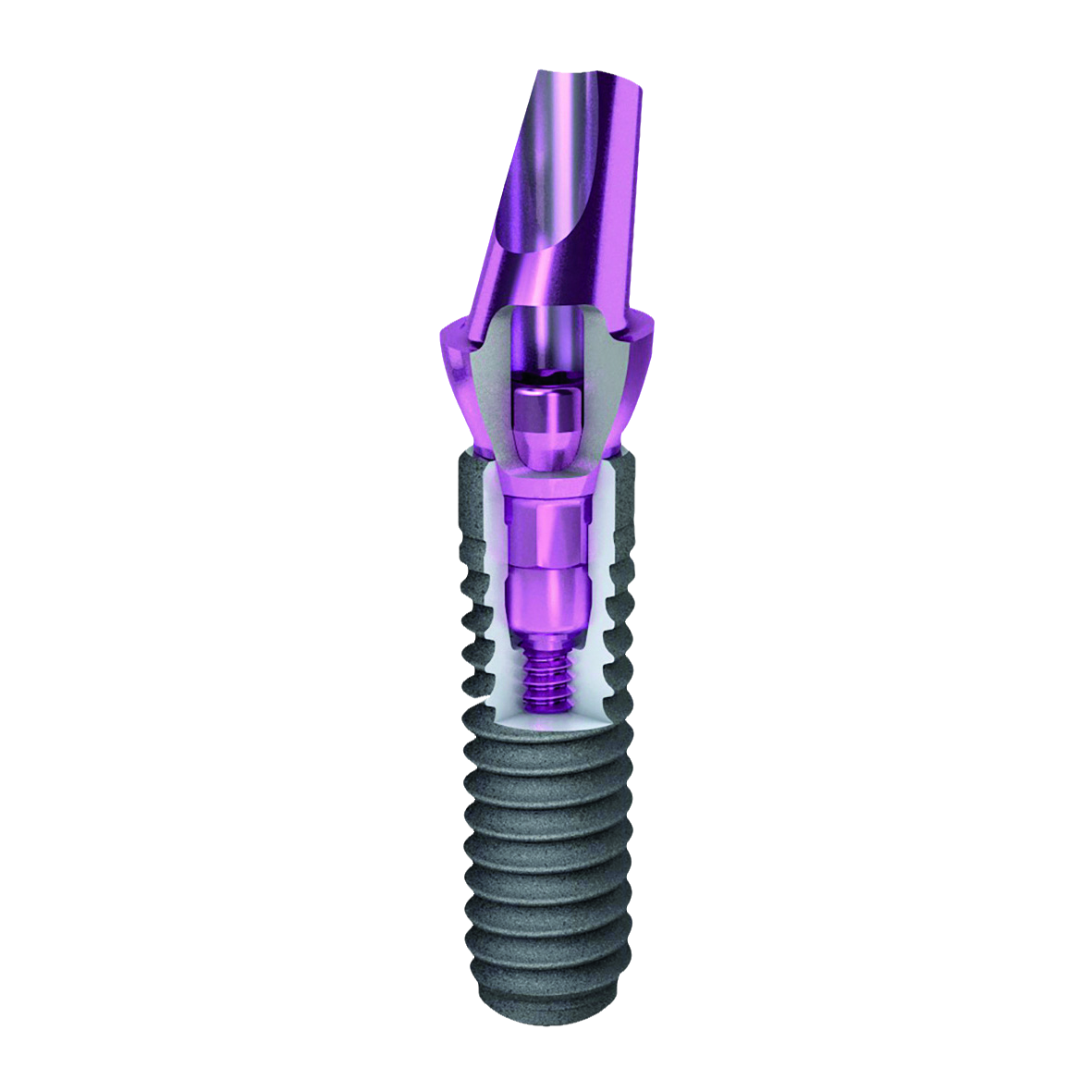 OKTAGON® Bone Level Regular Connect Abutment 18° Diameter 5.0mm Height 8.0mm Gingival Height 3.0mm