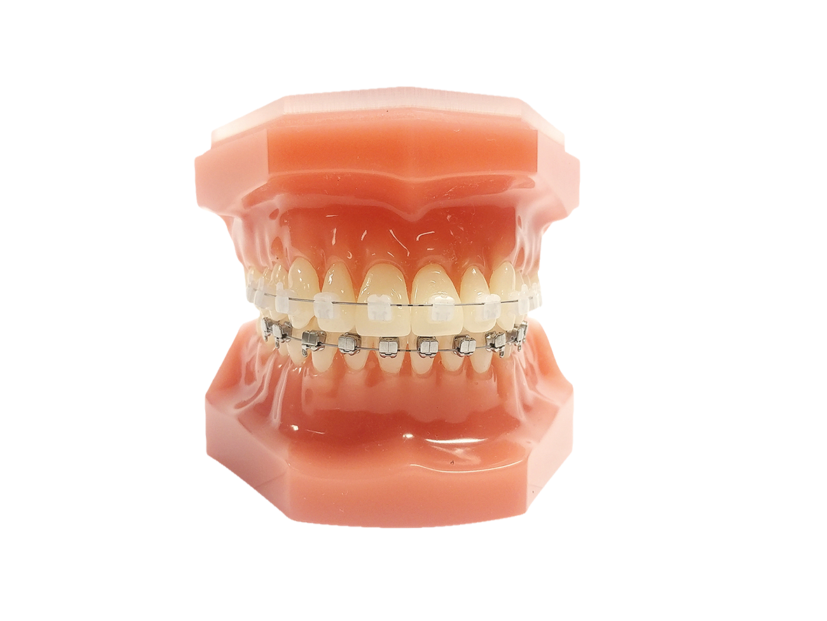 Typodont Carriere SLX 3D 7x7 Mixed