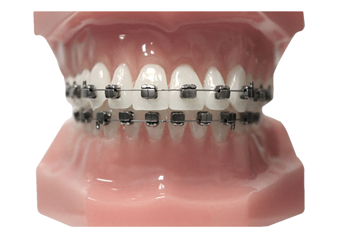 Typodont Carriere SLX 3D 7x7