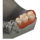 Ceramill Zolid FX Zirconia Disc A1 98x20 Ea