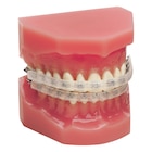 Ortho Organizers Lip Protector Ea