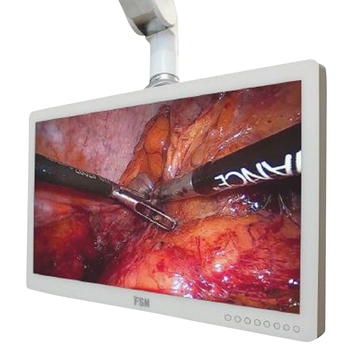 Surgical Monitor Each
