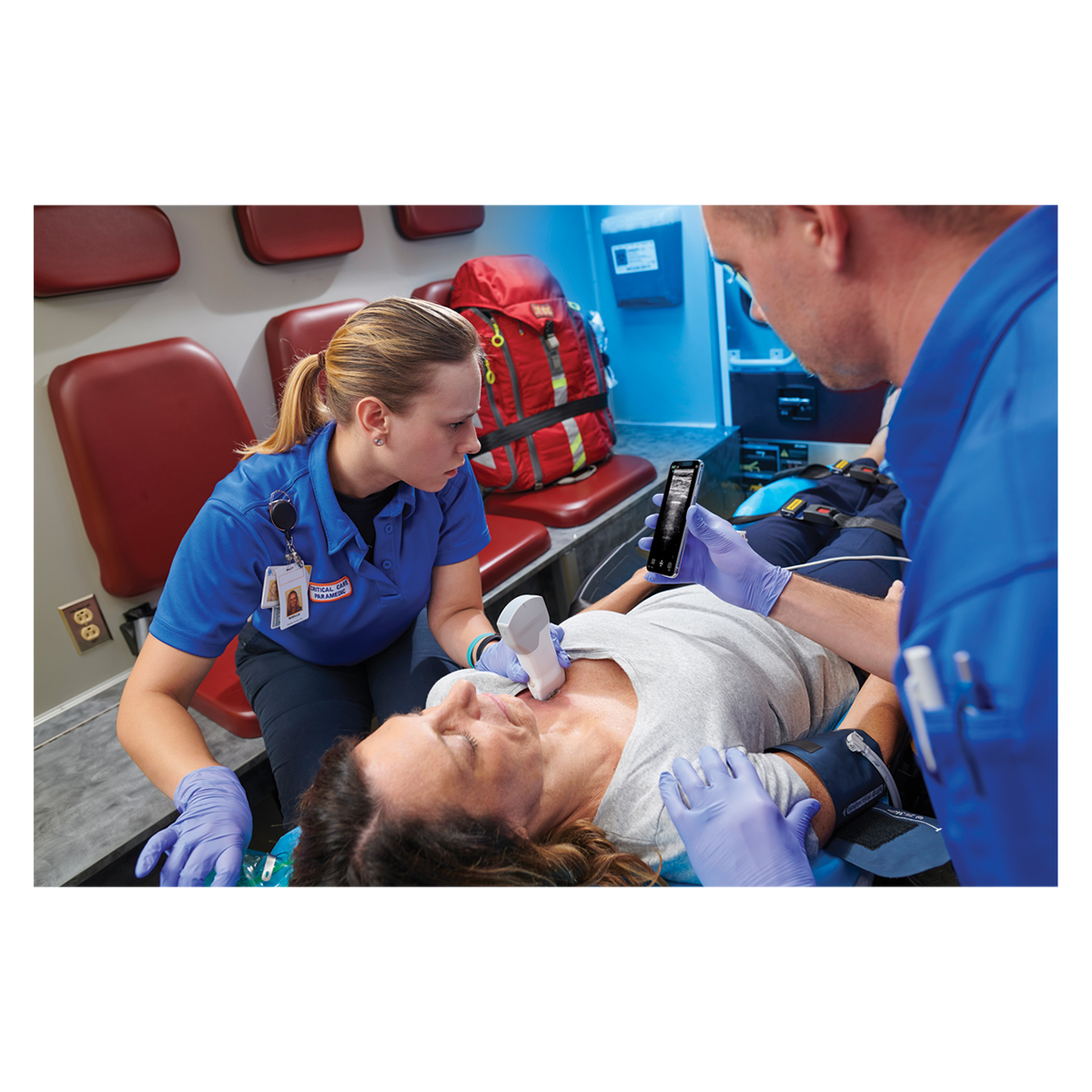 Vscan Extend R2 Ultrasound With DICOM Base Package Ea