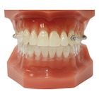 Carriere Motion 3D Class II Typodont Ea