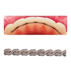 FlexTech Retention System Ea