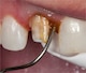 143122_NL_Front_03.jpg