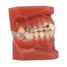 Carriere Motion Pro Typodont Ea