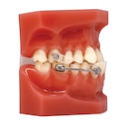 Carriere Motion Pro Typodont Ea