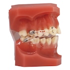 Carriere Motion Pro Clear Typodont Ea