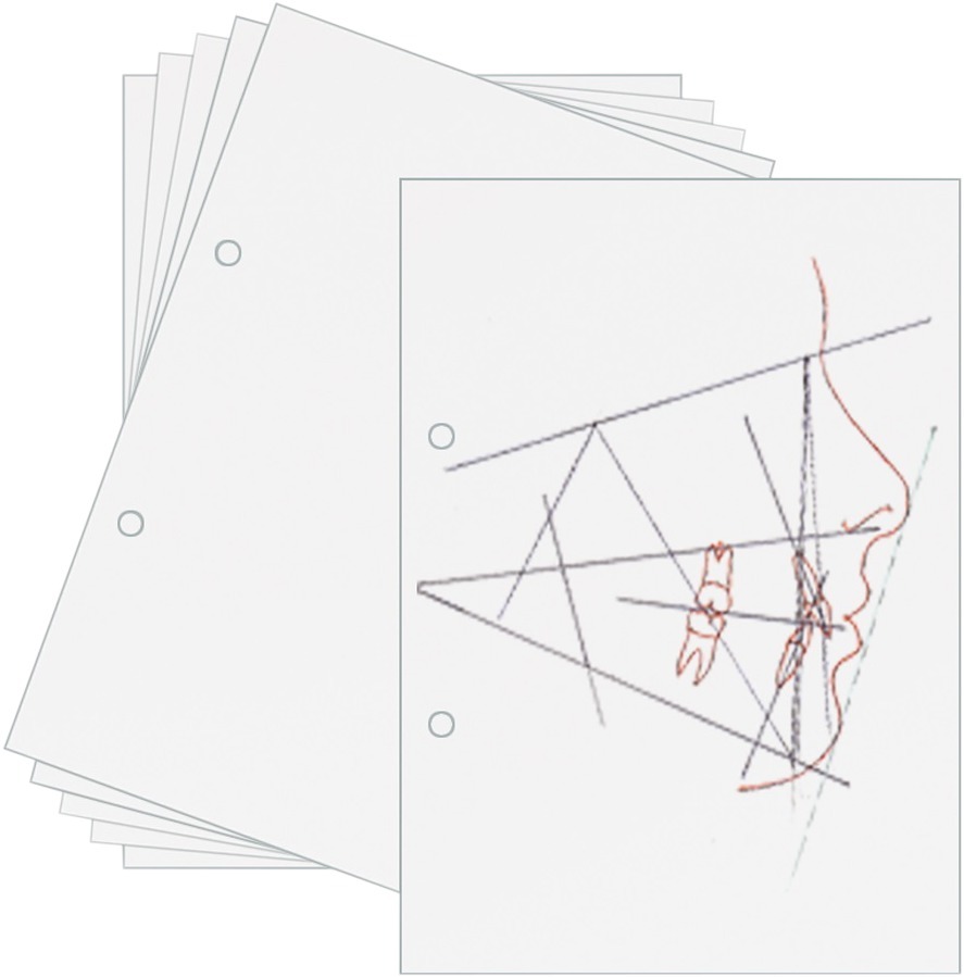 Tracing Paper - 24x30, 100 stuks (075-101-00)