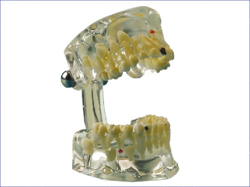 Demonstratiemodel transparant kind - 355643