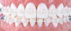 Draad Titanol Cosmetic coated - Boven, .014" (0,35 mm) - 10 stuks