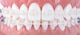300783_NL_Front_01.jpg