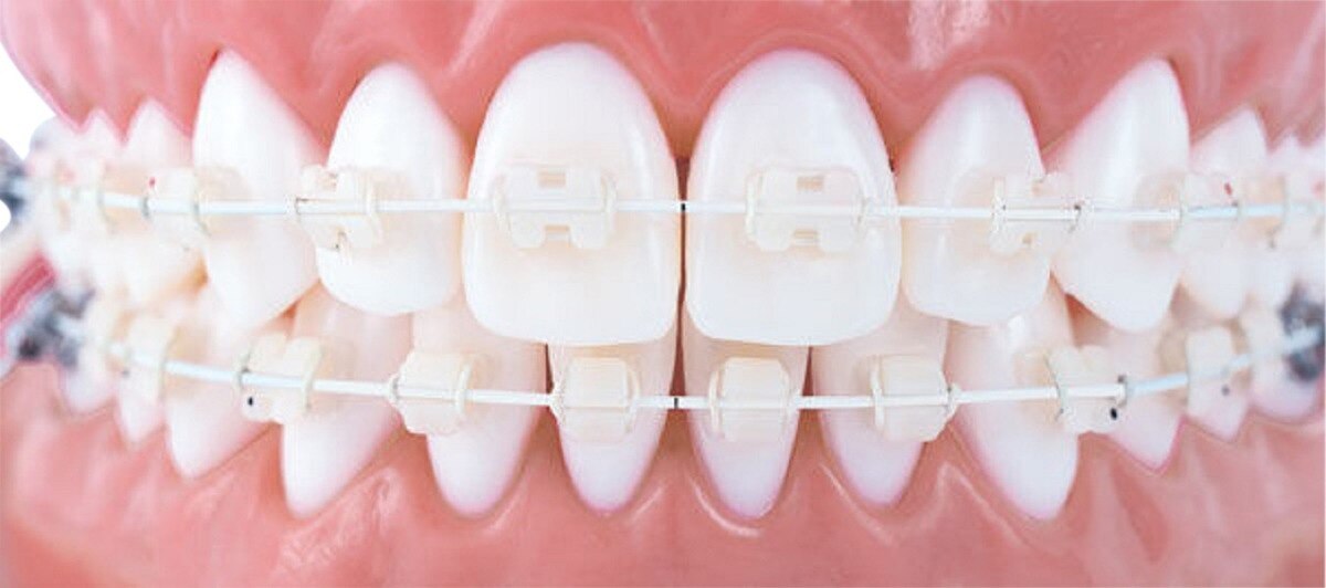 Draad Titanol Cosmetic coated - Onder, .014" (0,35 mm) - 10 stuks