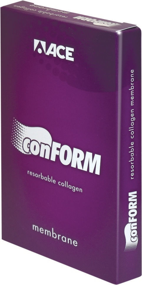 ConForm - 20 x 30 mm