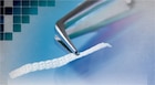 Ribbond THM Orthodontic kit - 222247