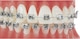503992_NL_Front_03.jpg