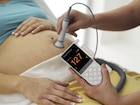 SR3-R doppler - op batterijen *levertijd onbekend*