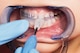 806317_NL_Front_03.jpg