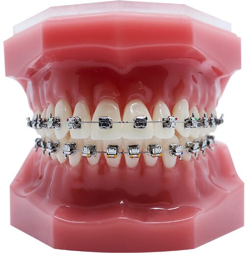 NuStar Gen 2 SLB - Roth 5x5 HKS U & L