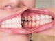 9505504_NL_Front_06.jpg