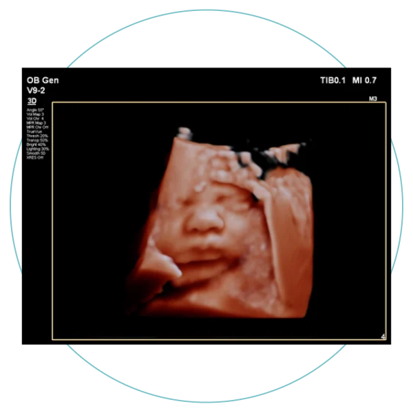 image-sec