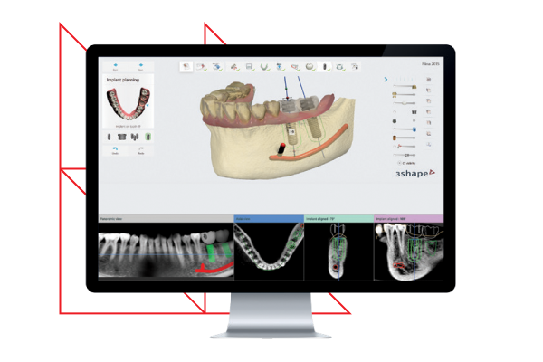 3shape software