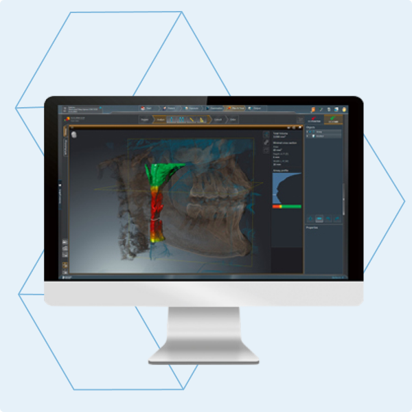 productCarousel Image