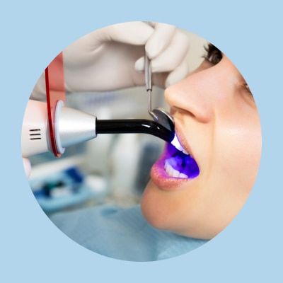 Modern Direct Restorations
