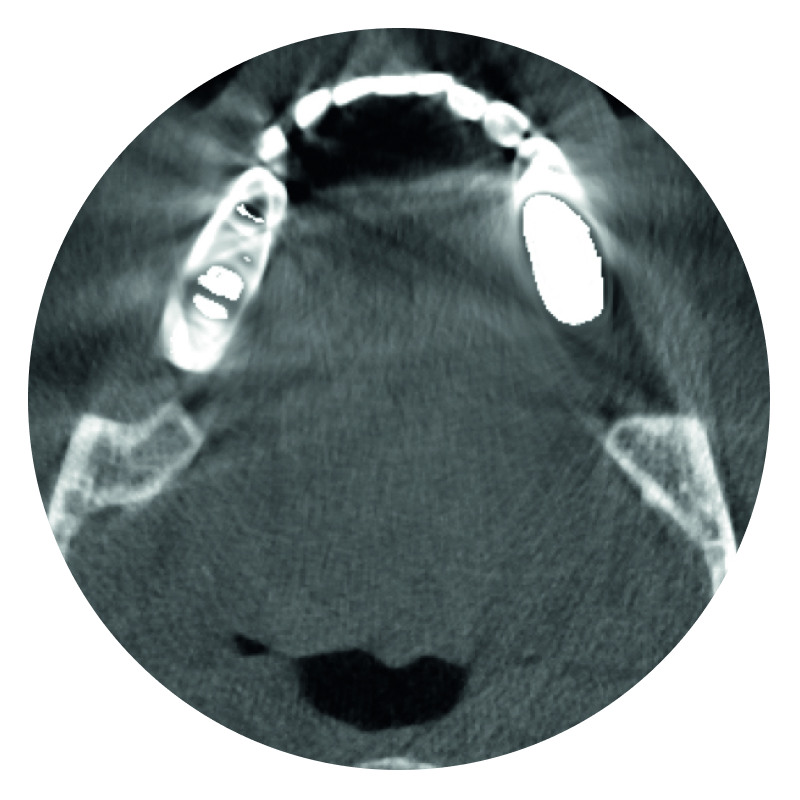 image-sec