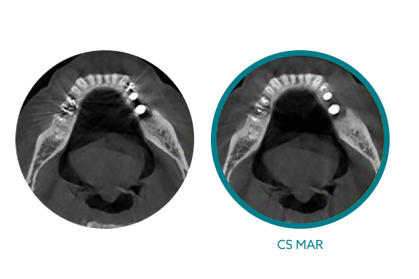 Carestream 8200 2D/3D